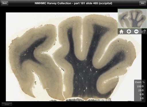 This digitized image made from a screen shot of a new iPad app, provided Sept. 24, 2012 by the National Museum of Health and Medicine Chicago, shows an image of brain tissue from renowned theoretical physicist Albert Einstein. The new application to be released Tuesday, Sept. 25 will allow users to see Einstein's brain as if they were looking through a microscope. The application promises to make detailed images of his brain more accessible to scientists than ever before. Teachers, students and anyone who's curious also can get a look. (AP Photo/Courtesy the National Museum of Health and Medicine Chicago)
