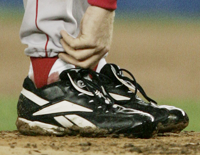 Boston Red Sox pitcher Curt Schilling tends to his right ankle during the third inning of game 6 of the American League Championship Series against the New York Yankees in this photo taken on Oct. 19. 2004, in New York.