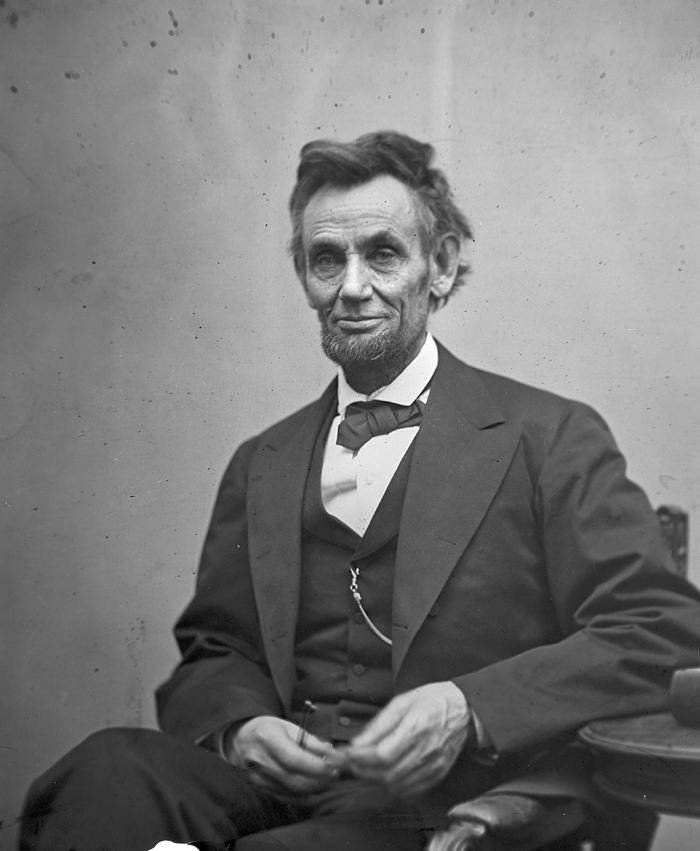 Some think President Abraham Lincoln may have had Marfan syndrome.