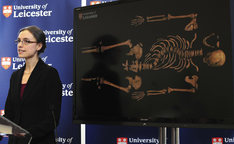 Jo Appleby stands in front of a picture of the skeleton that shows the spinal curvature of scoliosis.