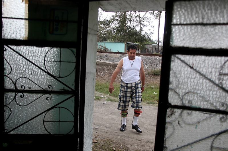 In this Wednesday March 6, 2013 photo, Jose Guadalupe Rodriguez-Saldana, 38, walks with orthopedic supports outside of his home in the town of Tierra Blanca, Veracruz state, Mexico. Rodriguez-Saldana and another friend suffered serious injuries during a car accident last May 2008 in northwestern Iowa. After their employers insurance coverage ran out, Rodriguez-Saldana, who was not a legal citizen, was placed on a private airplane and flown to Mexico still comatose and unable to discuss his care or voice his protest. Hospitals confronted with absorbing the cost of caring for uninsured seriously injured immigrants are quietly deporting them, often unconscious and unable to protest, back to their home countries. (AP Photo/Felix Marquez)