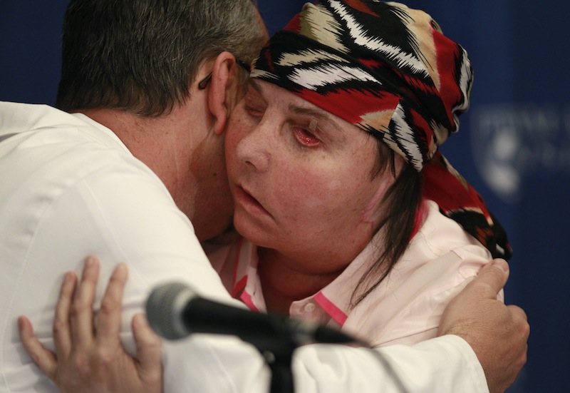 Carmen Blandin Tarleton of Thetford, Vt., embraces her surgeon, Dr. Bohdan Pomahac, during a news conference at Brigham and Women's Hospital in Boston, Mass., Wednesday, May 1, 2013. The 44-year-old mother of two underwent a successful face transplant in February after a 2007 attack in which her estranged husband doused her with industrial strength lye, burning more than 80 percent of her body. (AP Photo/Charles Krupa)