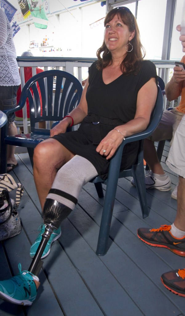 Boston Marathon bombing victim Karen Rand meets supporters in Old Orchard Beach for a fundraiser to help build a handicapped accessible home for Rand. Rand graduated from Westbrook High School and will be the ceremonial starter for this year's Beach to Beacon 10K race.
