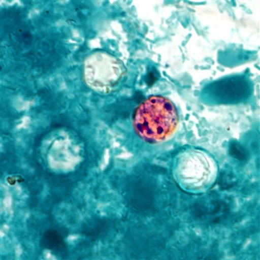 In this image provided by the Centers for Disease Control and Prevention, a photomicrograph of a fresh stool sample, which had been prepared using a 10% formalin solution, and stained with modified acid-fast stain, reveals the presence of four Cyclospora cayetanensis oocysts in the field of view. Iowa and Nebraska health officials say a prepackaged salad mix is the source of a cyclospora outbreak that sickened more than 178 people in both states. Cyclospora is a rare parasite that causes a lengthy gastrointestinal illness.