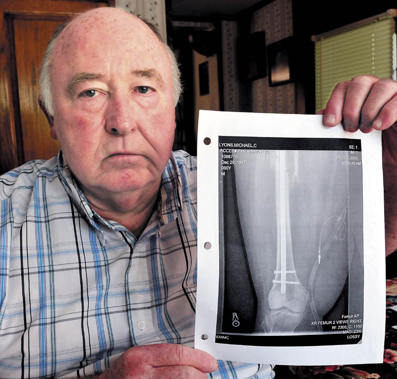 Mike Lyons, of Vassalboro, holds a copy of an X-ray of his femur, which was repaired after he was injured in a collision with an uninsured motorist in Winslow in 2008.