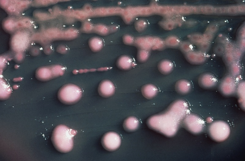 In this undated photo provided by the Centers for Disease Control and Prevention is one form of CRE bacteria, sometimes called “nightmare bacteria.” CRE bacteria is blamed for 600 deaths each year, and can withstand treatment from virtually every type of antibiotic. (AP Photo/Centers for Disease Control and Prevention)