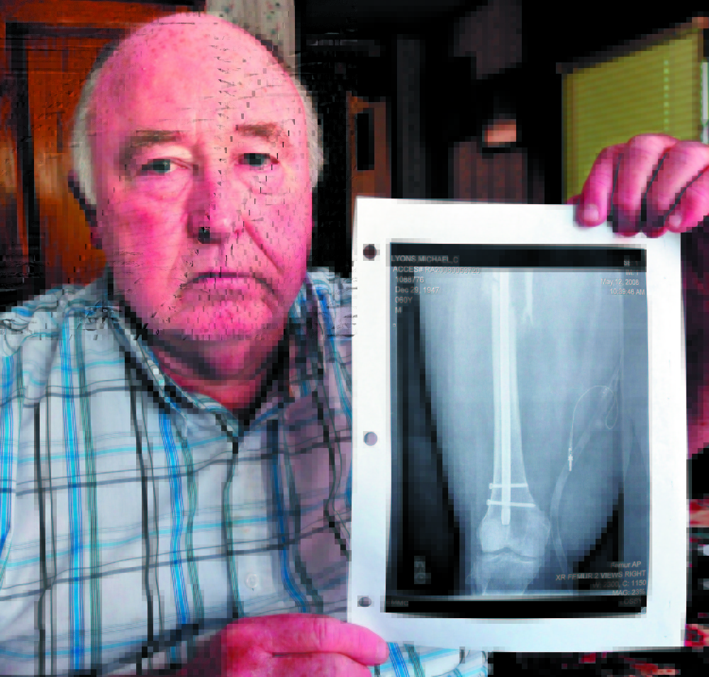 IMPACT: Mike Lyons of Vassalboro holds a copy of an X-ray of his femur that was repaired after it was injured severely when an uninsured motorist’s vehicle struck his in 2008 in Winslow. Lyons is promoting a bill that would increase penalties for some uninsured drivers. It was defeated by a Senate committee but is still up for consideration in the House.