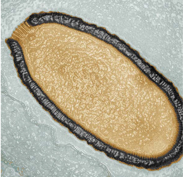 Transmission electron microscopy color image of a Pithovirus sibericum cross-section. This virion, dating back more than 30,000 years, is 1.5 microns long and 0.5 microns wide, which makes it the largest virus ever discovered. For comparison, the minimum width of a human hair is 17 microns.