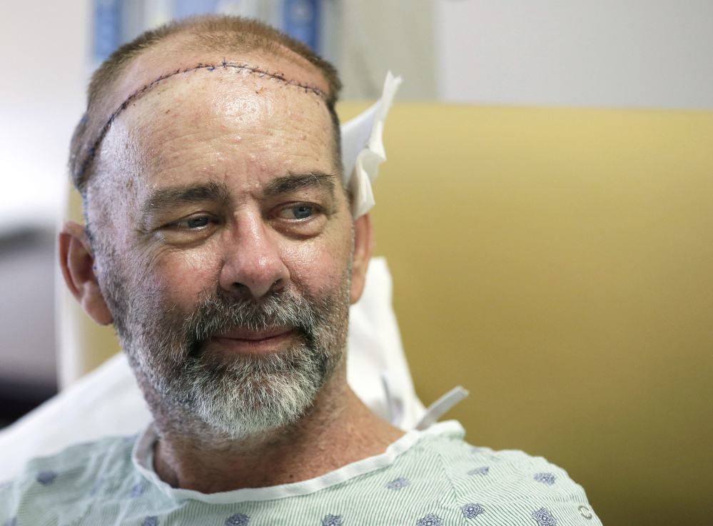 James Boysen is interviewed in his hospital bed at Houston Methodist Hospital in Houston. Texas doctors say he received the world’s first skull and scalp transplant from a human donor to help heal a large head wound from cancer treatment.