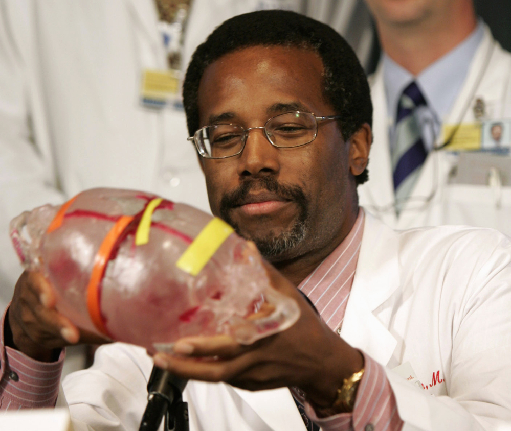 In this Sept. 16, 2004, file photo, Dr. Ben Carson, then-director of pediatric neurosurgery at Johns Hopkins Children’s Center, holds a model of the heads of conjoined twins Tabea and Lea Block of Lemgo, Germany, during a news conference in Baltimore.