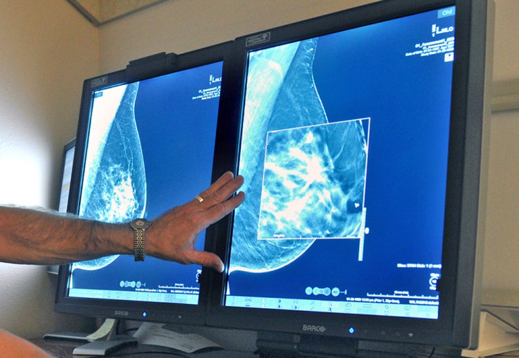 A radiologist compares an image from earlier, 2-D technology mammogram to the newer 3-D Digital Breast Tomosynthesis mammography. Torin Halsey/Times Record News via AP