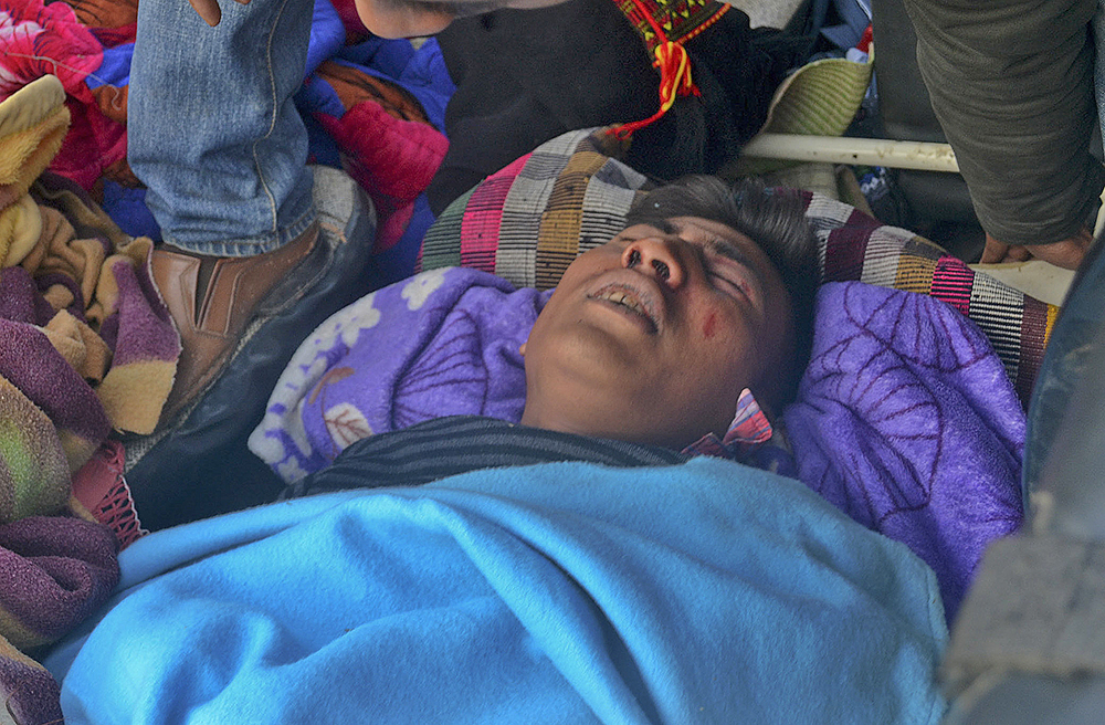 An Indian man grimaces in pain after he was injured in an earthquake in Imphal, capital of the northeastern state of Manipur, India, Monday. The Associated Press