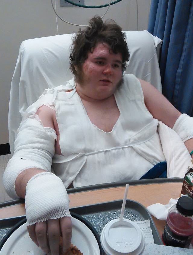 Dakota Pike, 15, recovers from burns at Maine Medical Center in Portland following a house fire Saturday in Oakland.
