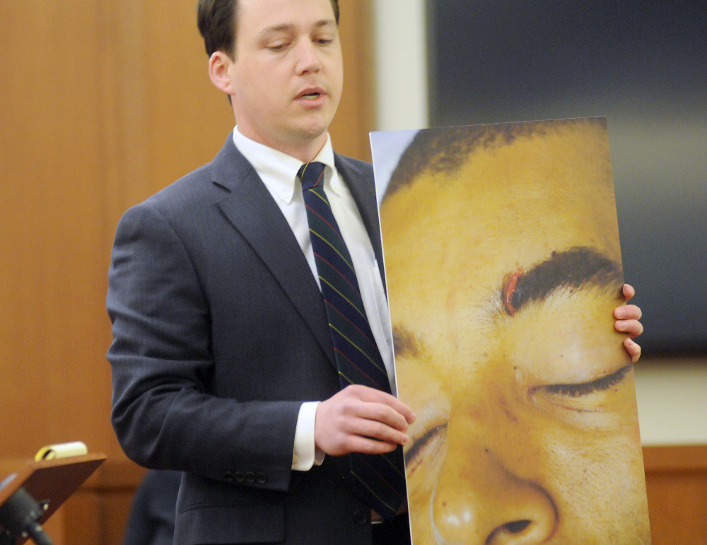 Defense attorney Caleb Gannon holds a photograph Monday of a knife wound on Justin Pillsbury’s eye that Pillsbury claims Jillian Jones inflicted at their Augusta apartment in Nov. 2013. Pillsbury is standing trial for the stabbing death of Jones.