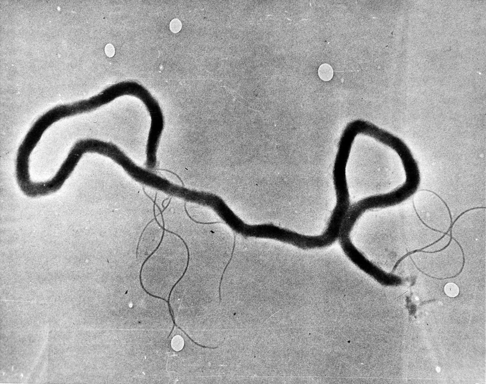 FILE - In this May 23, 1944 file photo, the organism treponema pallidum, which causes syphilis, is seen through an electron microscope. Las Vegas is experiencing a syphilis outbreak, as health officials warn of a national spike in cases that some are tying to increased testing, as well as the prevalence of anonymous sex through social media and a less consistent use of condoms. (AP Photo, File)