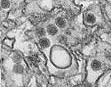 This microscope image from January provided by the Centers for Disease Control and Prevention shows the Zika virus.