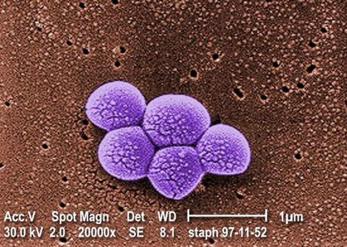 Magnified by 20,000X, this colorized scanning electron micrograph depicts a grouping of methicillin resistant Staphylococcus aureus (MRSA) bacteria. Public Health Image Library photo