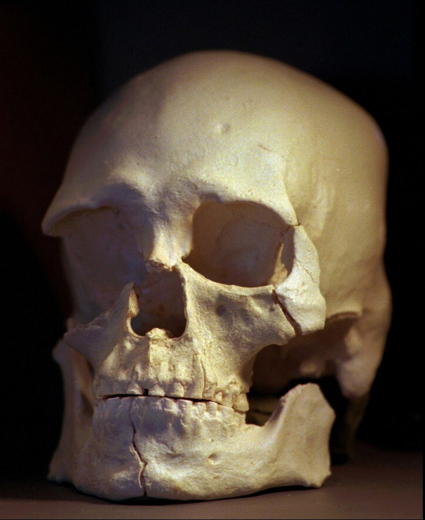 The skull of Kennewick Man, whose 9,000-year-old remains will be returned to U.S. Indian tribes for burial. Associated Press photo
