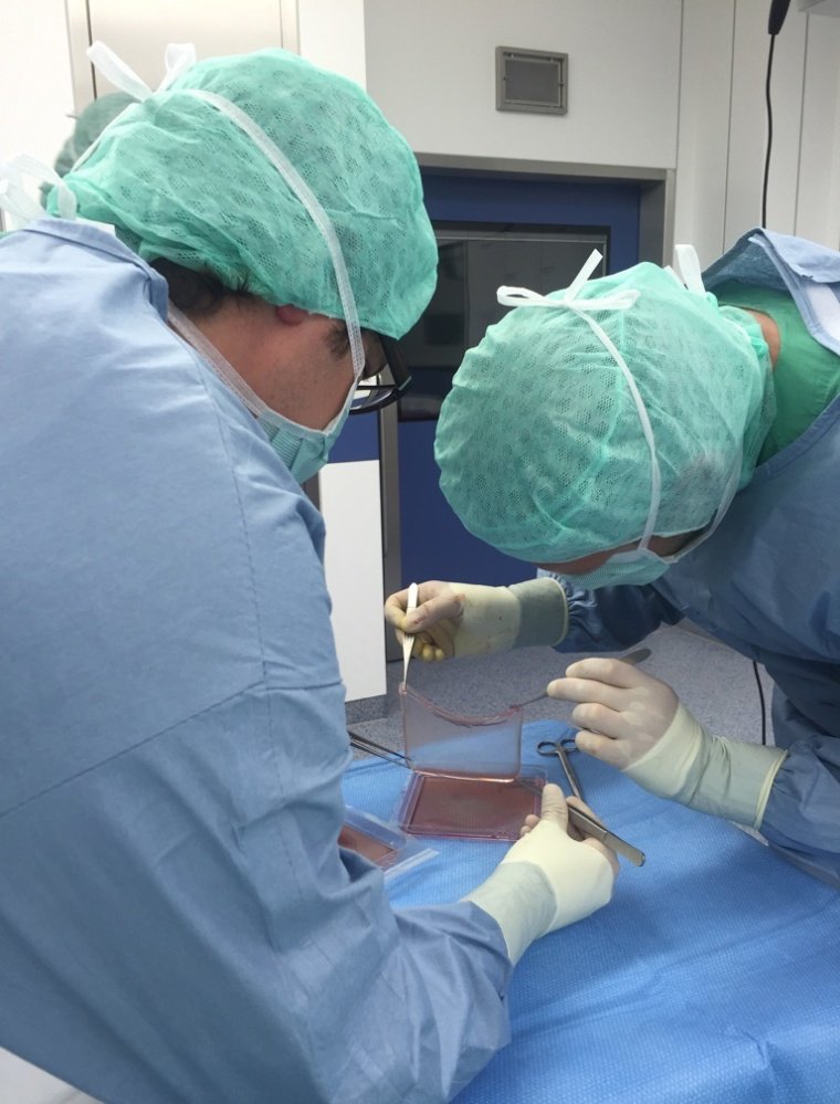 Doctors lift up a sheet of skin in a lab at St Josef-Hospital in Bochum, Germany. A boy treated two years ago with genetically modified skin is doing well today, doctors say.