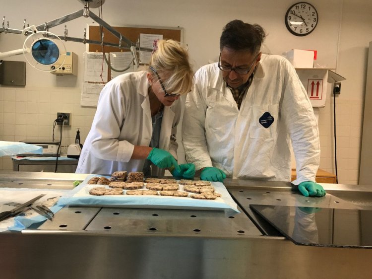 Ann McKee, director of the Boston University CTE Center, and neuropathologist Victor Alvarez conduct the study of the brain of former NFL player Aaron Hernandez.