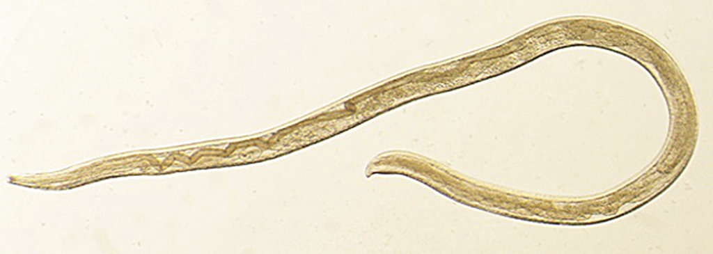 This undated photo provided by the Centers for Disease Control and Prevention (CDC) shows Thelazia gulosa, a type of eye worm seen in cattle in the northern United States and southern Canada, but never before in humans. 