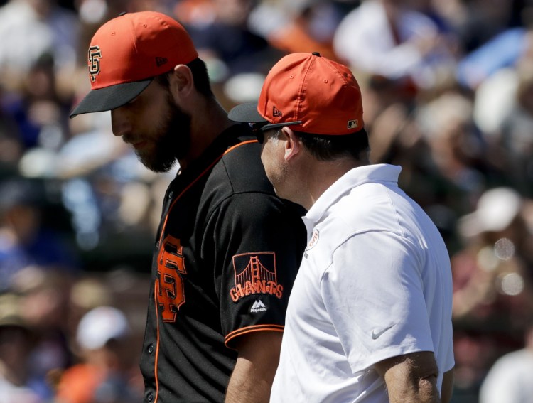 Pitcher Madison Bumgarner of the San Francisco Giants walks off the field with a trainer Friday after a line drive broke a bone in his pitching hand during a spring-training game