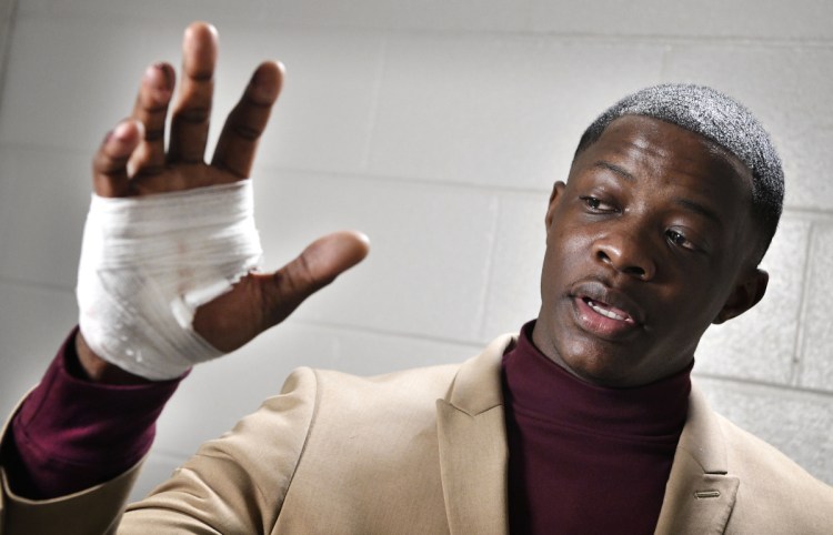James Shaw Jr. shows his hand that was injured when he disarmed a shooter inside a Waffle House on Sunday in Nashville, Tenn. 