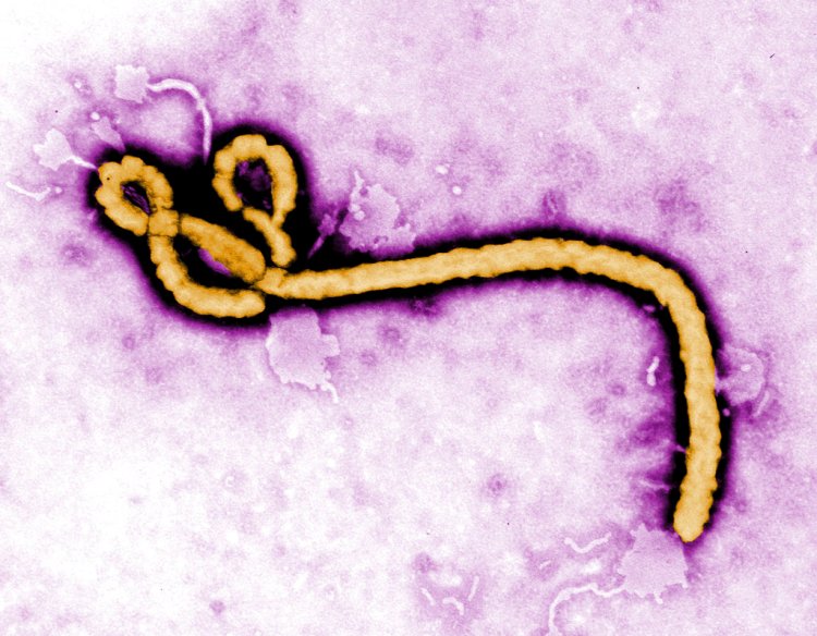 In this undated colorized transmission electron micrograph file image made available by the CDC shows an Ebola virus virion.  Congo's Ebola outbreak has spread to a city, the capital of the northwestern Equateur province, a worrying shift as the risk of infection is more easily passed on in densely populated urban areas.