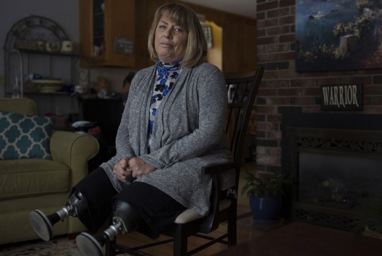 Terri Anthoine poses at her home in Portland on Tuesday. Anthoine lost both her legs when a car struck her last December, but refuses to hold a grudge and did not want the elderly driver sent to prison. "I can't be angry, because I won't ever get better. You just have to let the anger go."