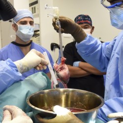 CORRECTION Pig Heart Transplant